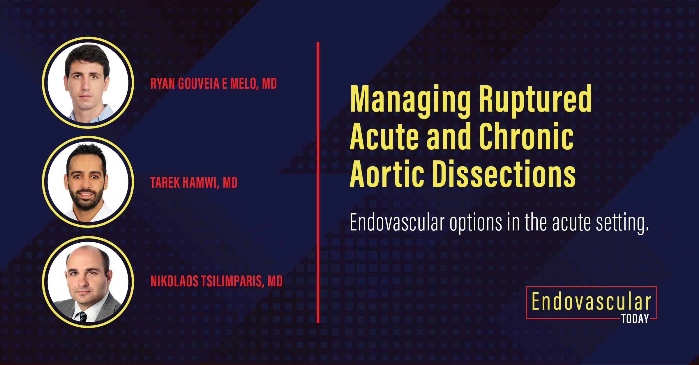 Managing Ruptured Acute and Chronic Aortic Dissections - Endovascular Today